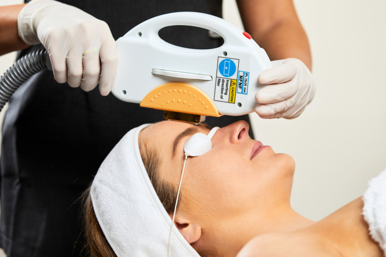 SuperLUX IPL Laser machine photo rejuvenation treatment being performed with an IPL machine to reduce the appearance of fine lines an wrinkles, and target age management