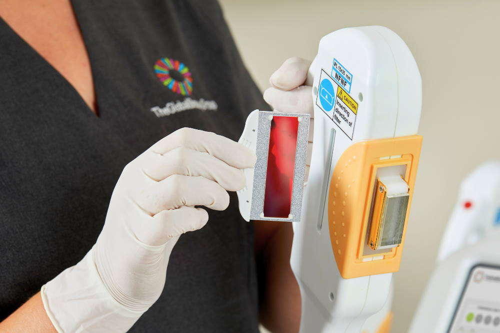 Placing wavelength filter into IPL machine handpiece for targeted aesthetic treatment