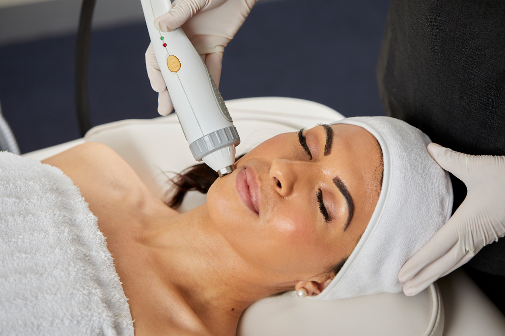 RF skin tightening treatment on client’s face for non-surgical facial rejuvenation