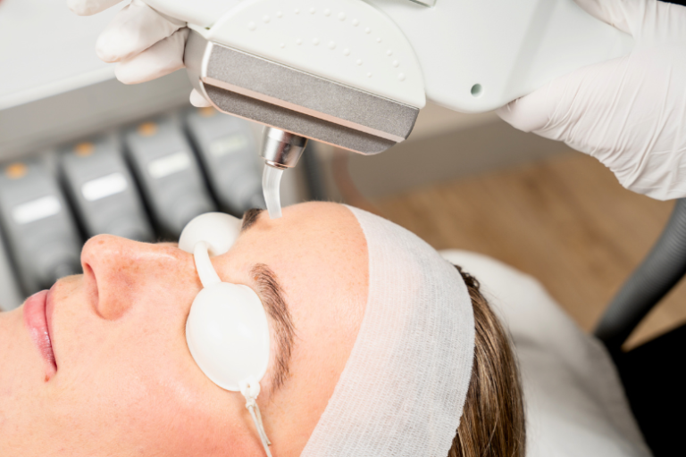 A LUXAdapt tip for the handpiece of IPL Laser machine to make treatments easier and more comfortable on smaller or precise areas