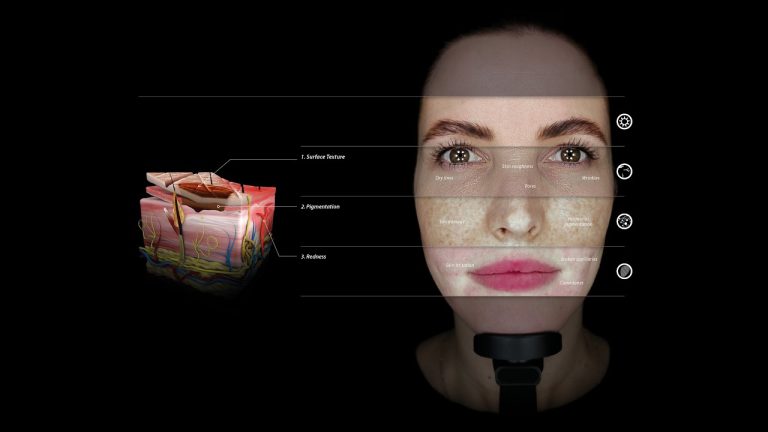 OBSERV 320: Streamlined Skin Analysis technology