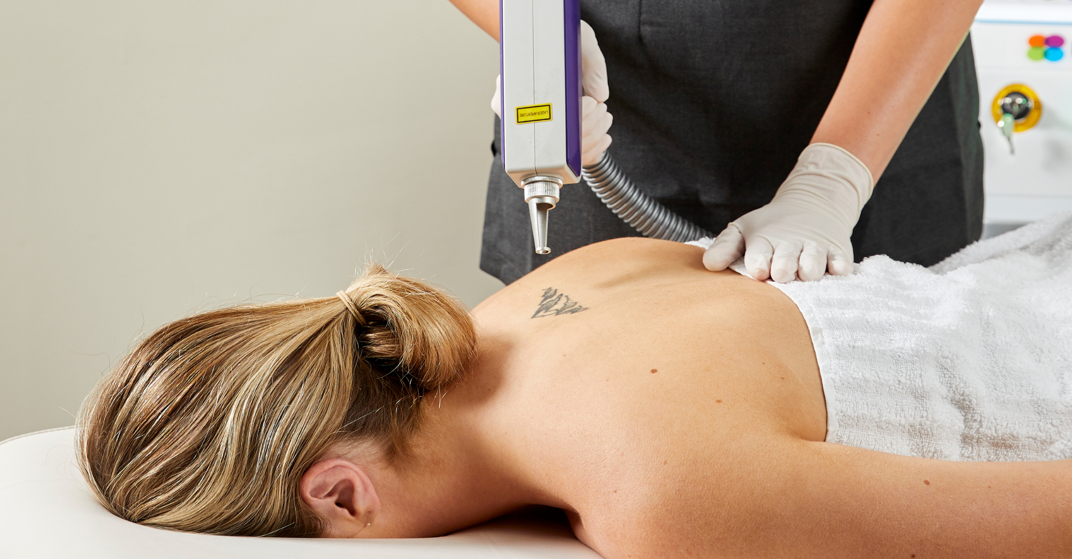 TATTTOO REMOVAL MACHINE treatment for back tattoo
