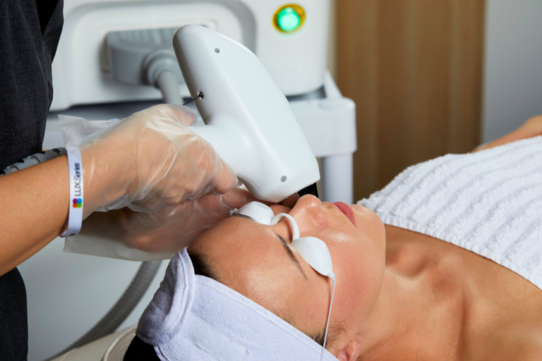 HAIRLASE TREATMENT on the face with laser hair removal machine