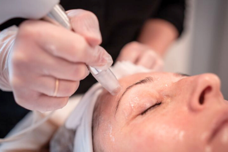MICRONEEDLING MACHINE facial treatment for collagen induction therapy