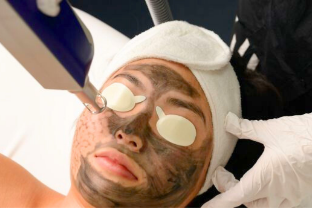 ULTRALASE laser tattoo removal machine technology carbon facial